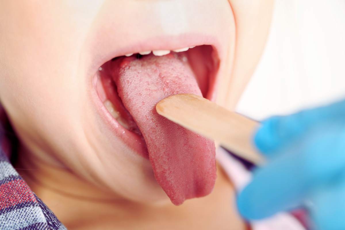 Dolore alla lingua, cosa può essere